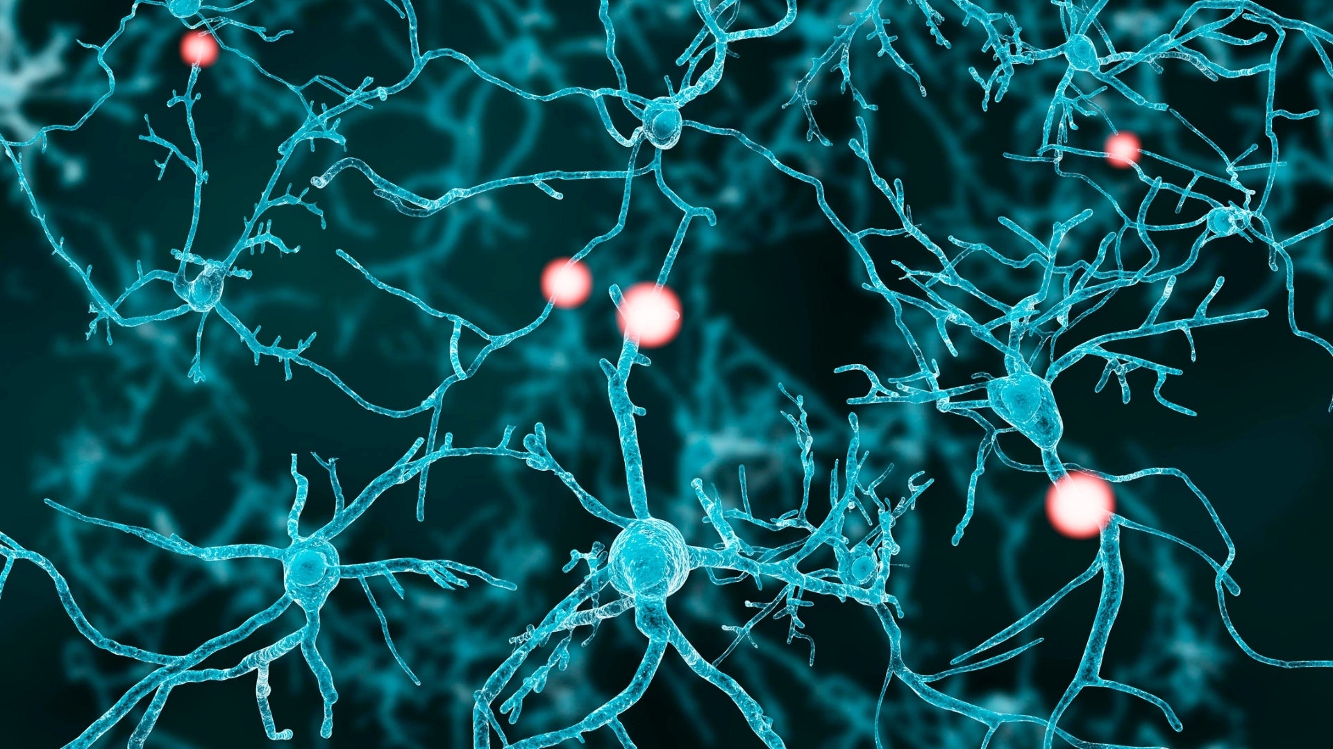 Neural Mobilization:  A new Systematic Review Analyzes Therapeutic Efficacy